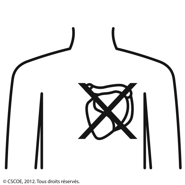 Arret cardiaque2_NB