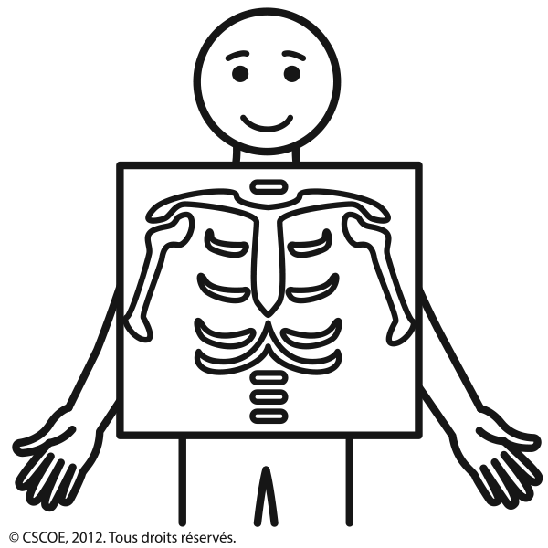 Radiographie_NB